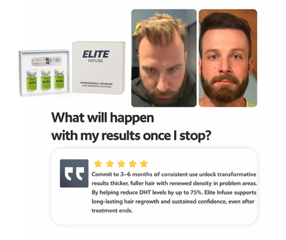 EliteInfuse™ Hair Regrowth System