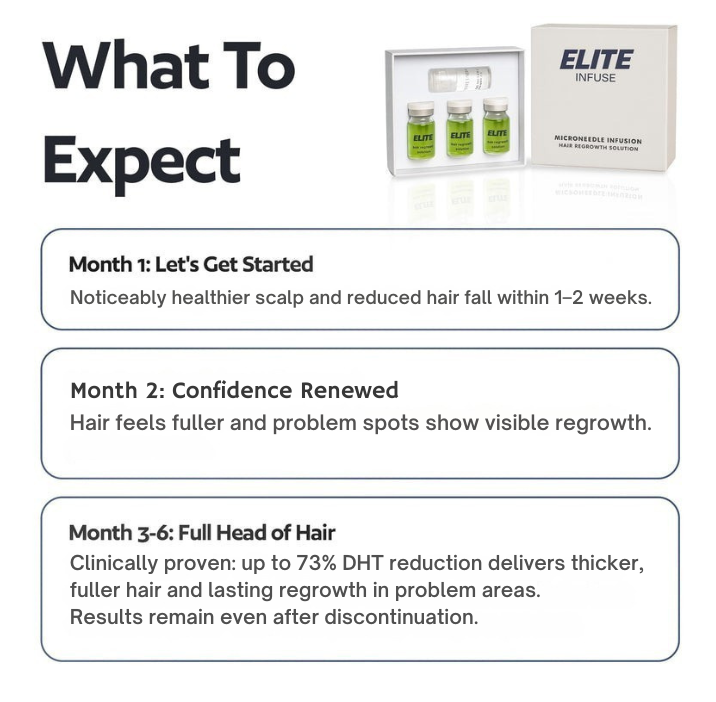 EliteInfuse™ Hair Regrowth System